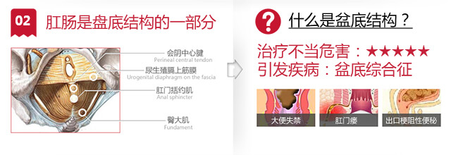 肛肠疾病引发盆底综合症